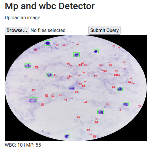 Malaria and white blood cell detection