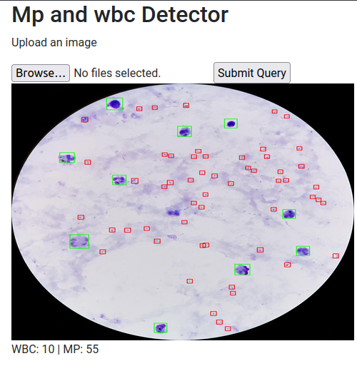 Performance Evaluation of YOLOv12 Models for Malaria Parasite and White Blood Cell Detection